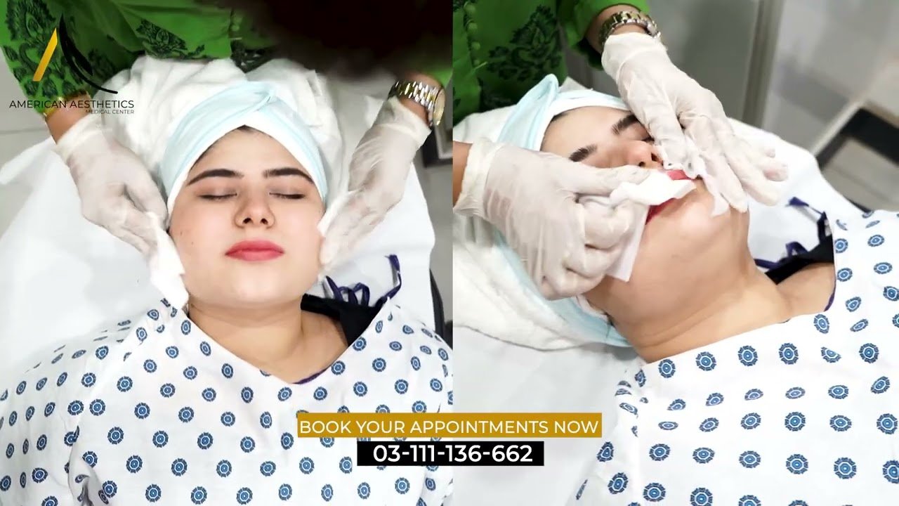 Before and after facial rejuvenation